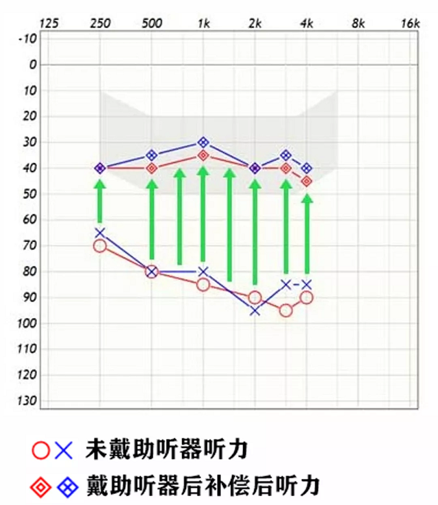 听力图